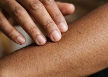 O maior órgão do corpo humano consegue renovar sua superfície continuamente
