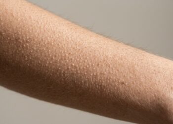 O que faz algumas pessoas sentirem arrepios do nada, mesmo sem estarem com frio