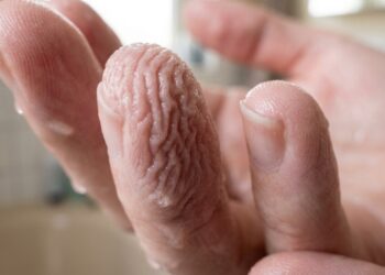 Para que servem as “ruguinhas” que aparecem nos dedos depois do banho e por que o corpo faz isso