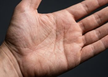 Por que temos linhas nas palmas das mãos, elas se formam no 3º mês de gestação e sua função real não tem nada a ver com destino mas com um problema de engenharia que o corpo precisou resolver