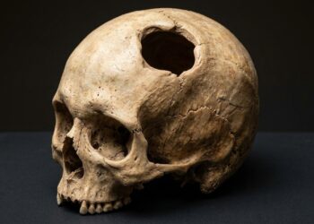 Crânio pré-colombiano peruano com abertura de trepanação e bordas ósseas cicatrizadas. - (Imagem gerada por inteligência artificial-ChatGPT/Olhar Digital)
