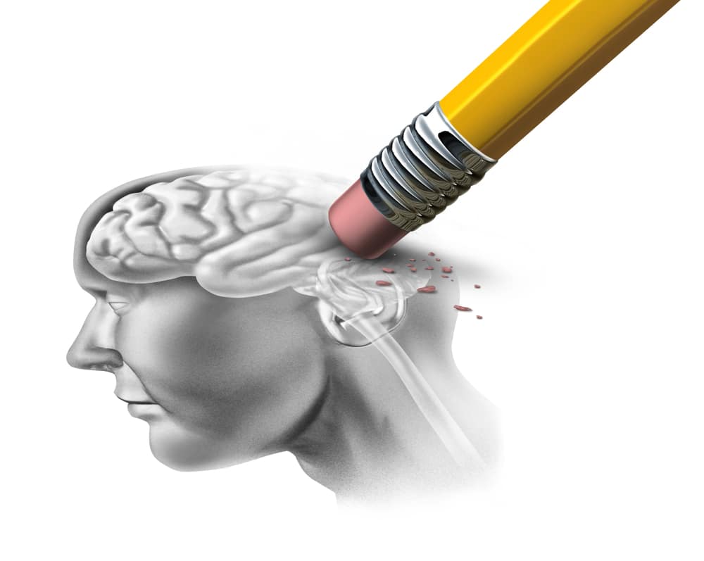 Desenho representando doenças degenerativas cerebrais