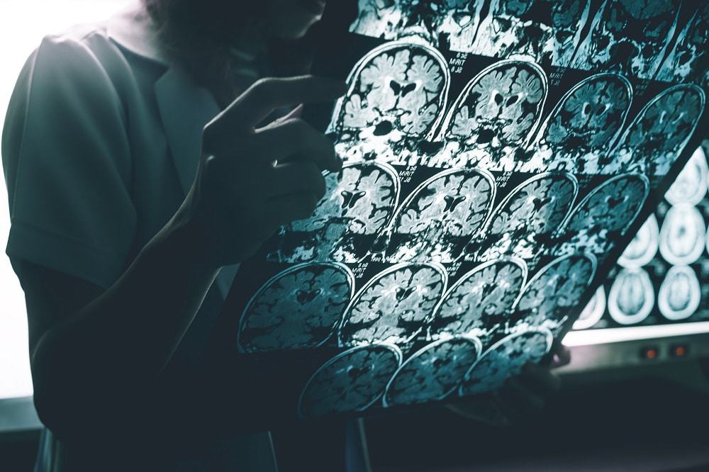 Alzheimer. Imagem: Shutter-e-Atthapon