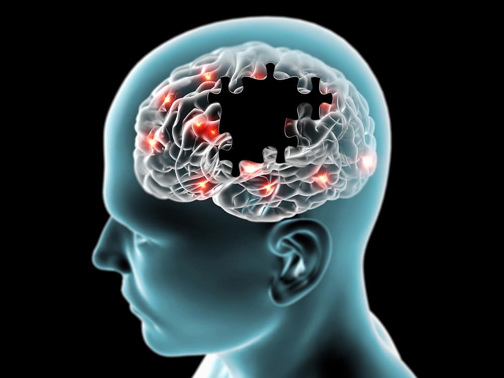 Representação gráfica de doenças degenerativas cerebrais