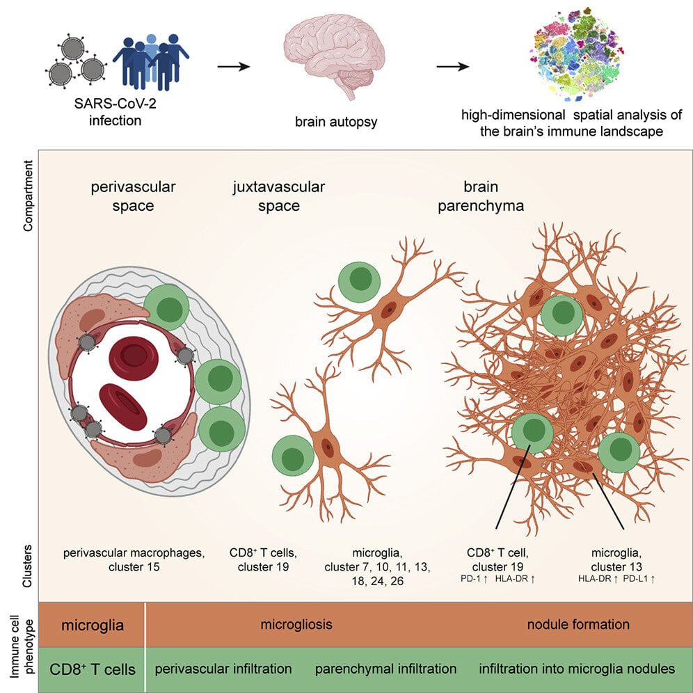 Covid-19 pode causar inflamação grave no cérebro, indica estudo. Imagem: Immunuty