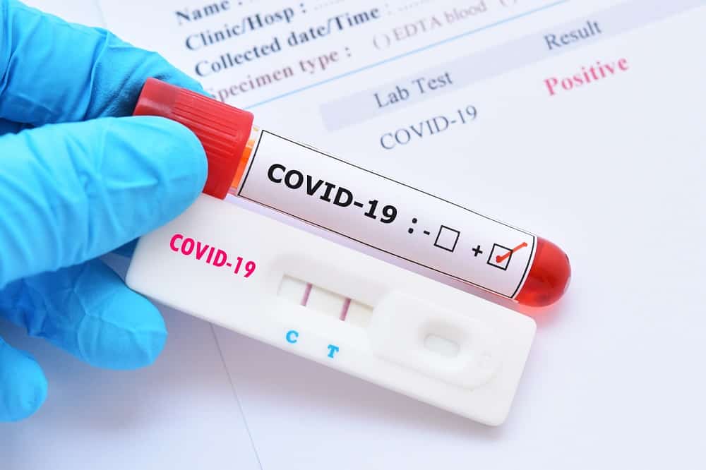 covid-19 américa latina