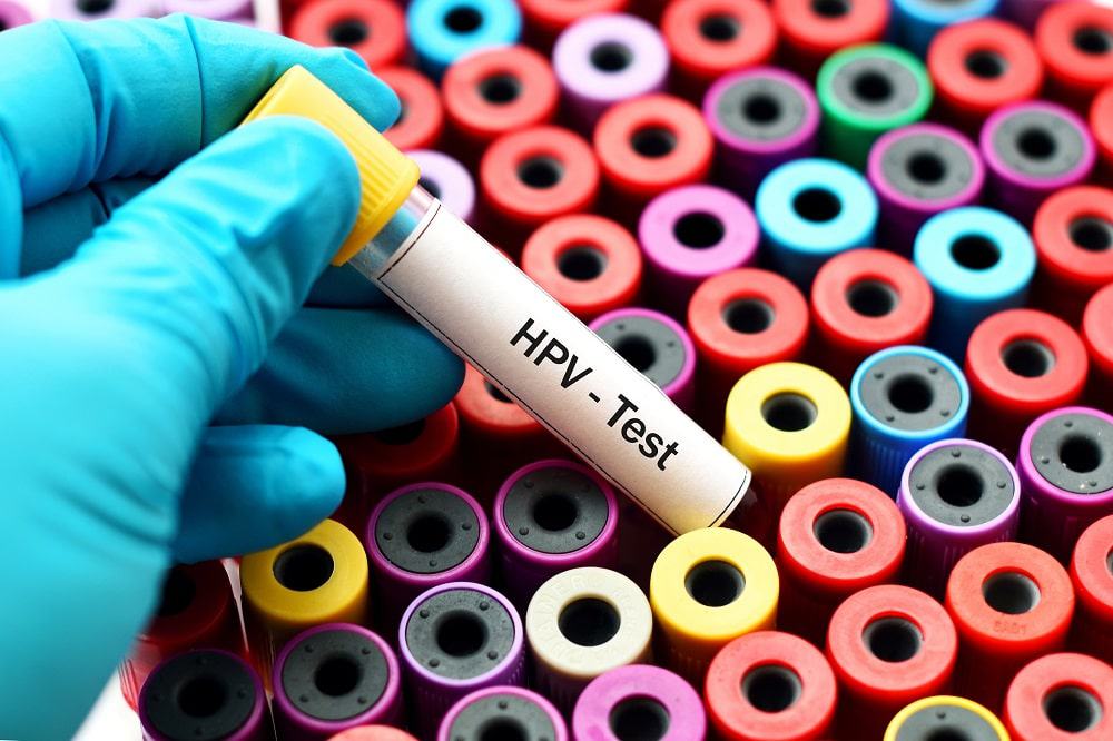 teste HPV