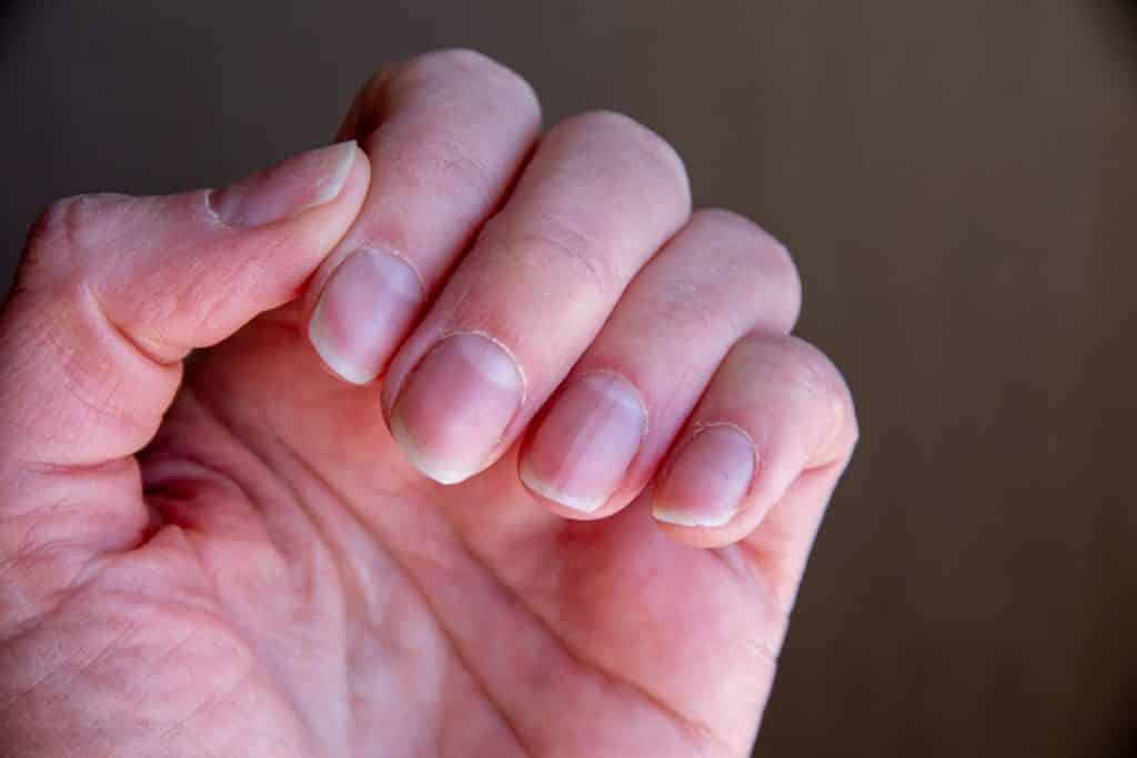 Unhas onduladas