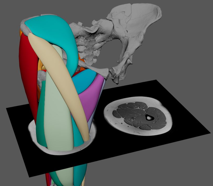  Wiseman usou varreduras de humanos modernos como referência para colocar músculos em um modelo virtual do esqueleto de Lucy. 