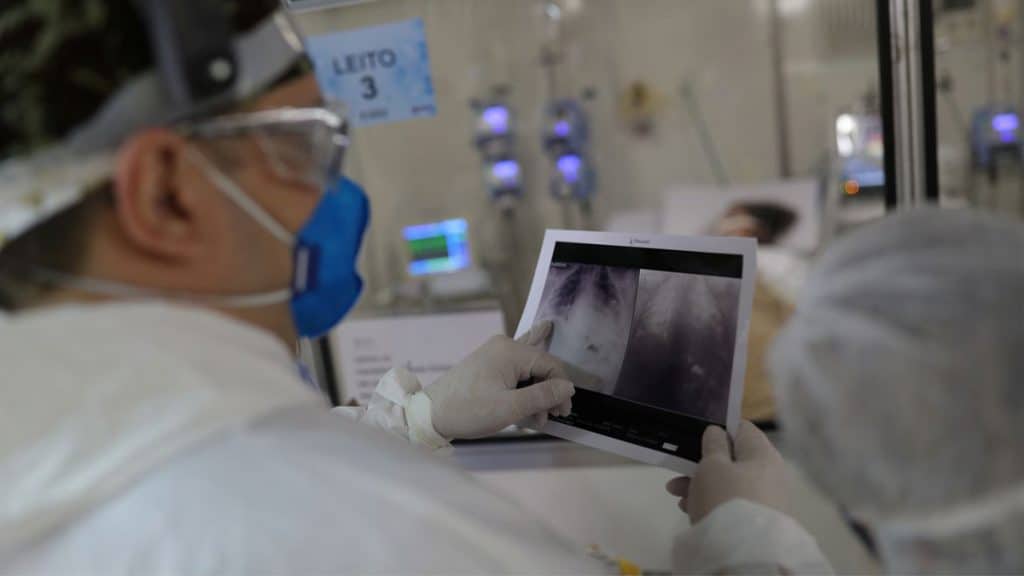 Médico olhando para raio-x de pulmões de paciente com Covid-19