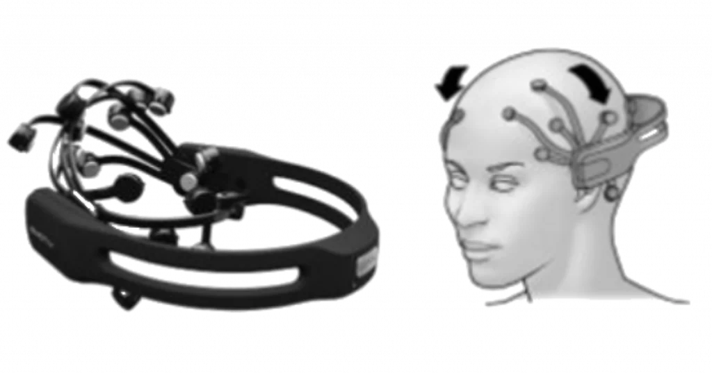 eletroencefalografia