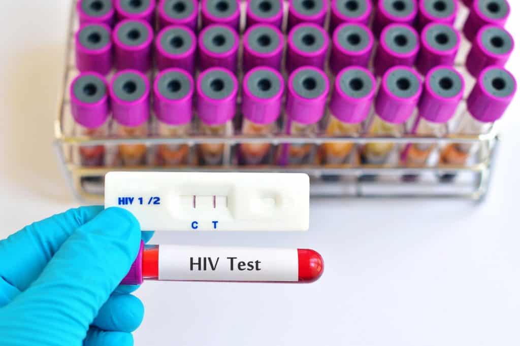hiv