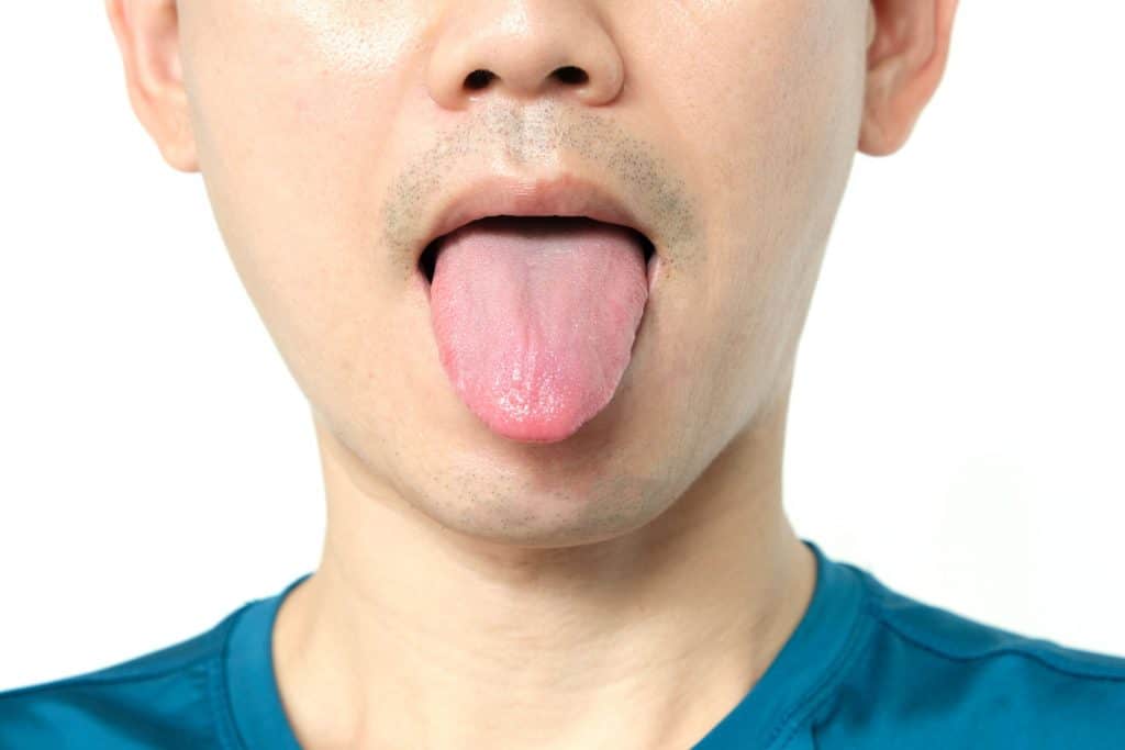 Como e por que a língua indica problemas de saúde? Apesar de muitas vezes ser esquecida nos cuidados diários, a língua pode revelar muito sobre a saúde geral do corpo. A cor, a textura e até o formato da língua ajudam a identificar deficiências nutricionais, infecções, inflamações e até doenças sistêmicas. Como e por que a língua indica problemas de saúde?