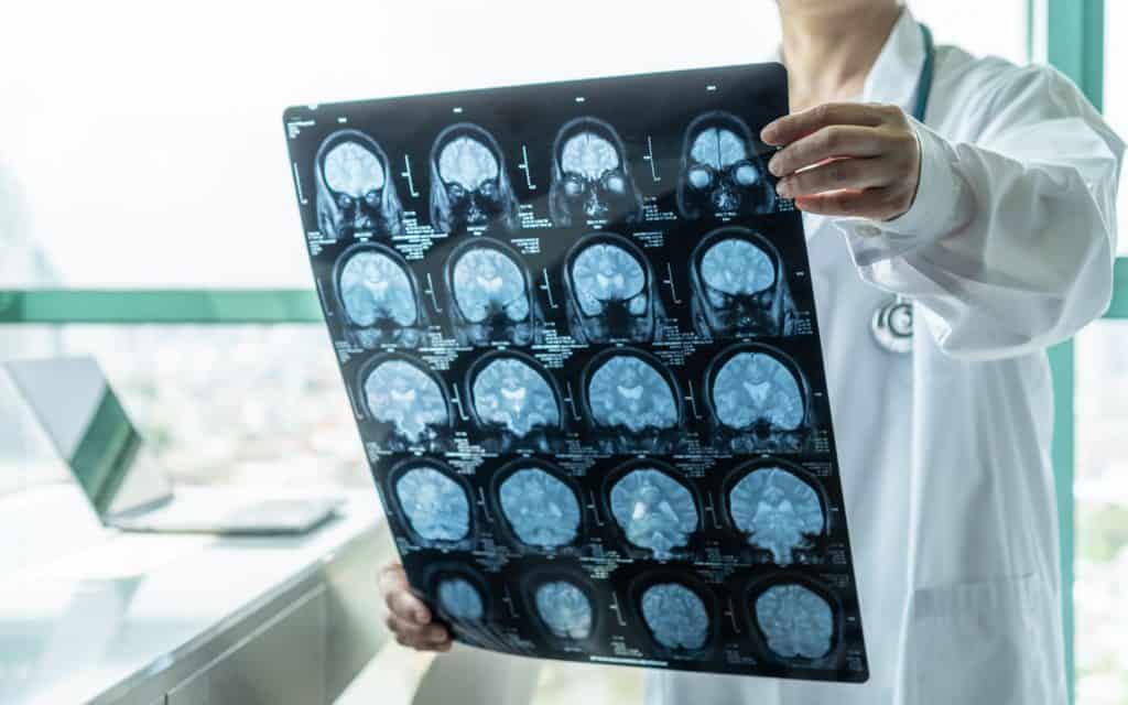 doença cerebral