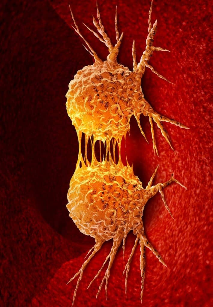 Dividing,Cancer,Cell,Metastasis,Division,As,A,Disease,Anatomy,Concept