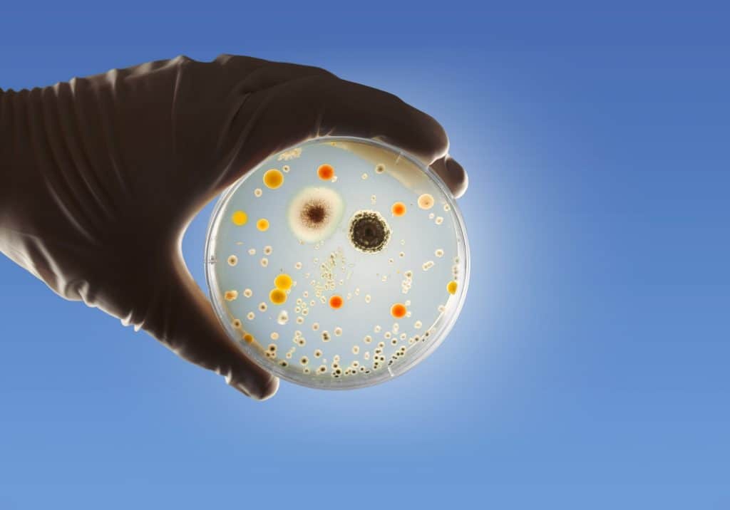 Médico ou cientista segurando uma placa de petri com cultura microbiológica