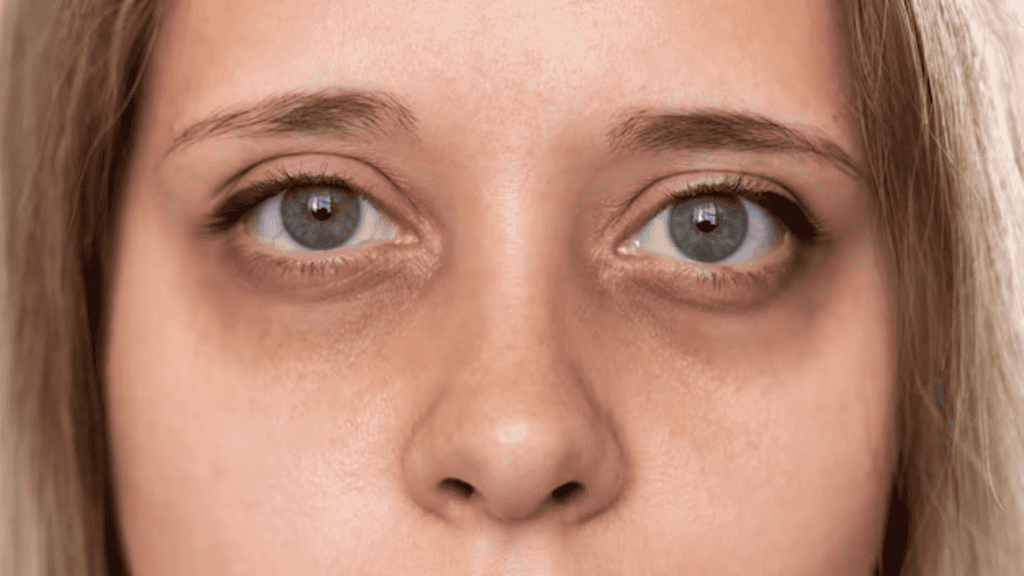 10 sinais que mostram que você está desidratado e quando buscar ajuda médica Na rotina intensa do dia a dia, é muito comum que nos esqueçamos de algo básico para a nossa saúde: beber água. A hidratação é essencial para regular a temperatura corporal, manter a circulação sanguínea, auxiliar na digestão e garantir o bom funcionamento das células. 10 sinais que mostram que você está desidratado e quando buscar ajuda médica
