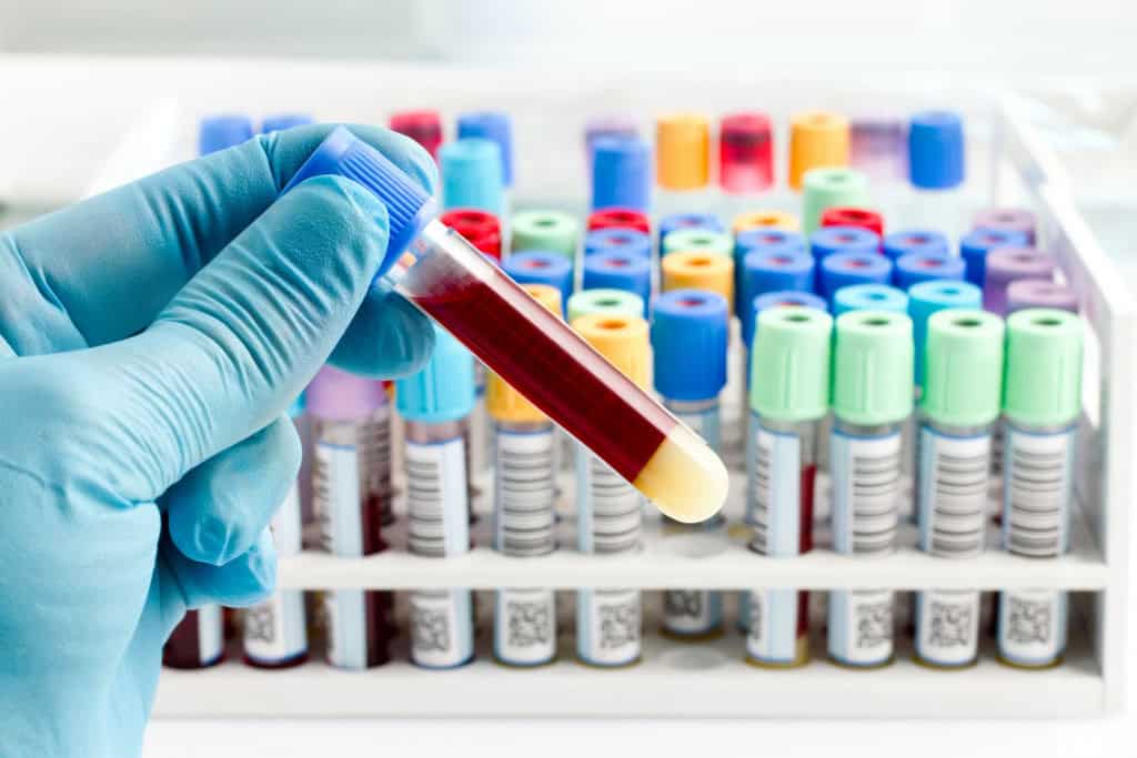 Cientistas recriam sangue humano em laboratório Pesquisadores de Cambridge desenvolveram um método para recriar sangue humano em laboratório. Em um estudo publicado na Cell Reports, a equipe explica que a nova técnica imita a formação natural observada em embriões para produzir as células sanguíneas funcionais. sangue