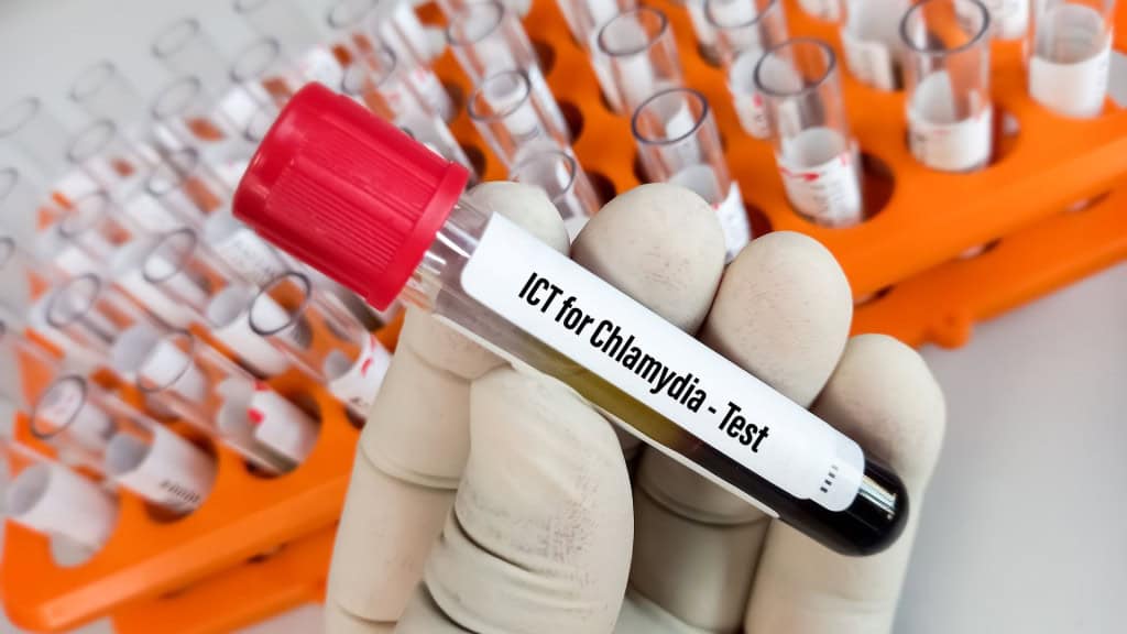 7 ISTs perigosas, mas com sintomas silenciosos A lista de infecções sexualmente transmissíveis é extensa. No entanto, algumas apresentam consequências ainda mais graves à saúde e, o pior, é que a maioria das ISTs carregam sintomas silenciosos, o que dificulta o diagnóstico precoce e retarda a busca pelo tratamento. Amostra de sangue para teste de clamídia (ICT), doença sexualmente transmissível comum causada pela bactéria Chlamydia trachomatis