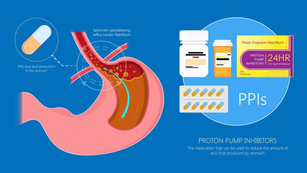 Imagem mostra o interior do corpo humano com foco no estômago e esôfago. Um tubo vermelho representa o esôfago levando alimentos ao estômago, onde há líquido amarelado (ácido).