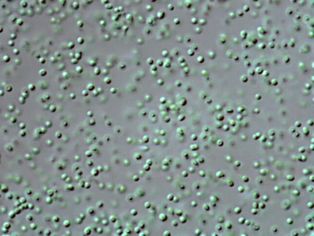 Mudanças climáticas podem impactar o oxigênio da Terra; entenda Você já ouviu falar do Prochlorococcus? Esse minúsculo micróbio marinho é responsável por quase um terço da produção de oxigênio do nosso planeta, sendo fundamental para criar as condições que garantem a nossa existência. Mudanças climáticas podem impactar o oxigênio da Terra; entenda