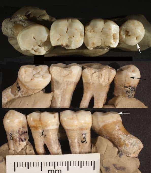 Novo estudo questiona o “hábito mais antigo da humanidade” Um novo estudo desafia a hipótese de que os hominídeos ancestrais usavam palitos de dente. Ao questionar dezenas de pesquisa anteriores, os autores alertam que é preciso cautela ao formular suposições sobre o comportamento humano primitivo. O estudo foi publicado na edição de setembro da revista científica American Journal of Biological Anthropology. Novo estudo questiona o “hábito mais antigo da humanidade”