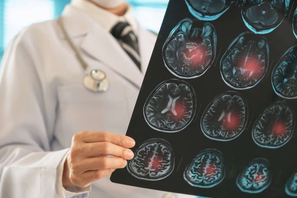 Médico olhando uma tomografia