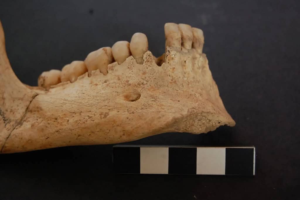 Detalhes da arcada dentária de um dos crânios