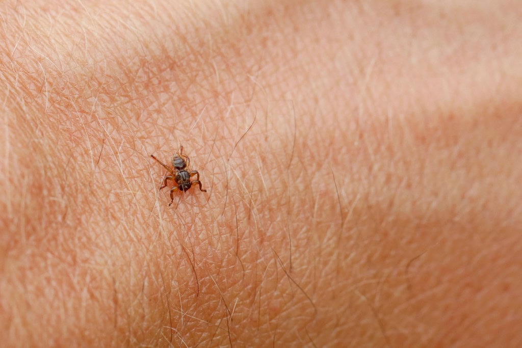Mosca-do-cervo em pele humana