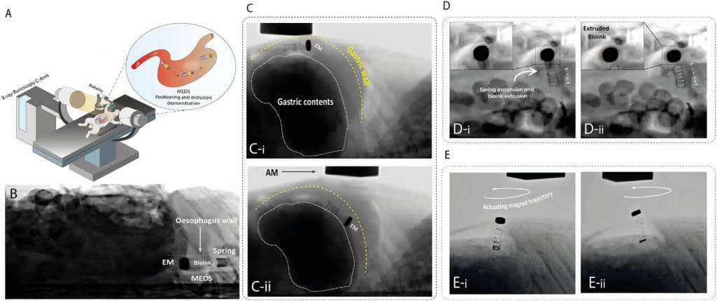 Diagrama com implantação in vivo do MEDS com fluoroscopia
