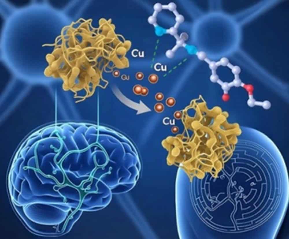 Novo composto químico pode ajudar a combater Alzheimer Estimativas apontam que cerca de 50 milhões de pessoas sofram com o Alzheimer no mundo todo, número que pode subir para mais de 130 milhões até 2050. A doença neurodegenerativa é caracterizada pela perda gradual de funções cognitivas, como memória, linguagem e raciocínio. Novo composto químico pode ajudar a combater Alzheimer