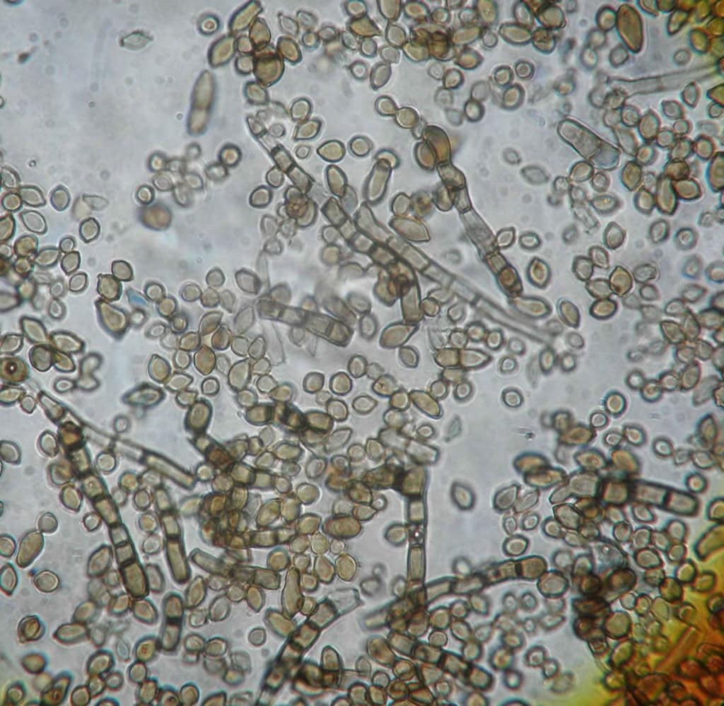 Fungos de Chernobyl intrigam cientistas ao crescer com radiação A Zona de Exclusão de Chernobyl continua proibida para visitantes, mas a ausência de humanos abriu espaço para formas de vida que surpreendem pesquisadores há décadas. Entre esses organismos, um fungo escuro encontrado nas paredes internas de estruturas próximas ao reator acidentado tem chamado atenção por algo incomum: ele parece crescer melhor quando exposto à radiação ionizante. Fungos de Chernobyl intrigam cientistas ao crescer com radiação