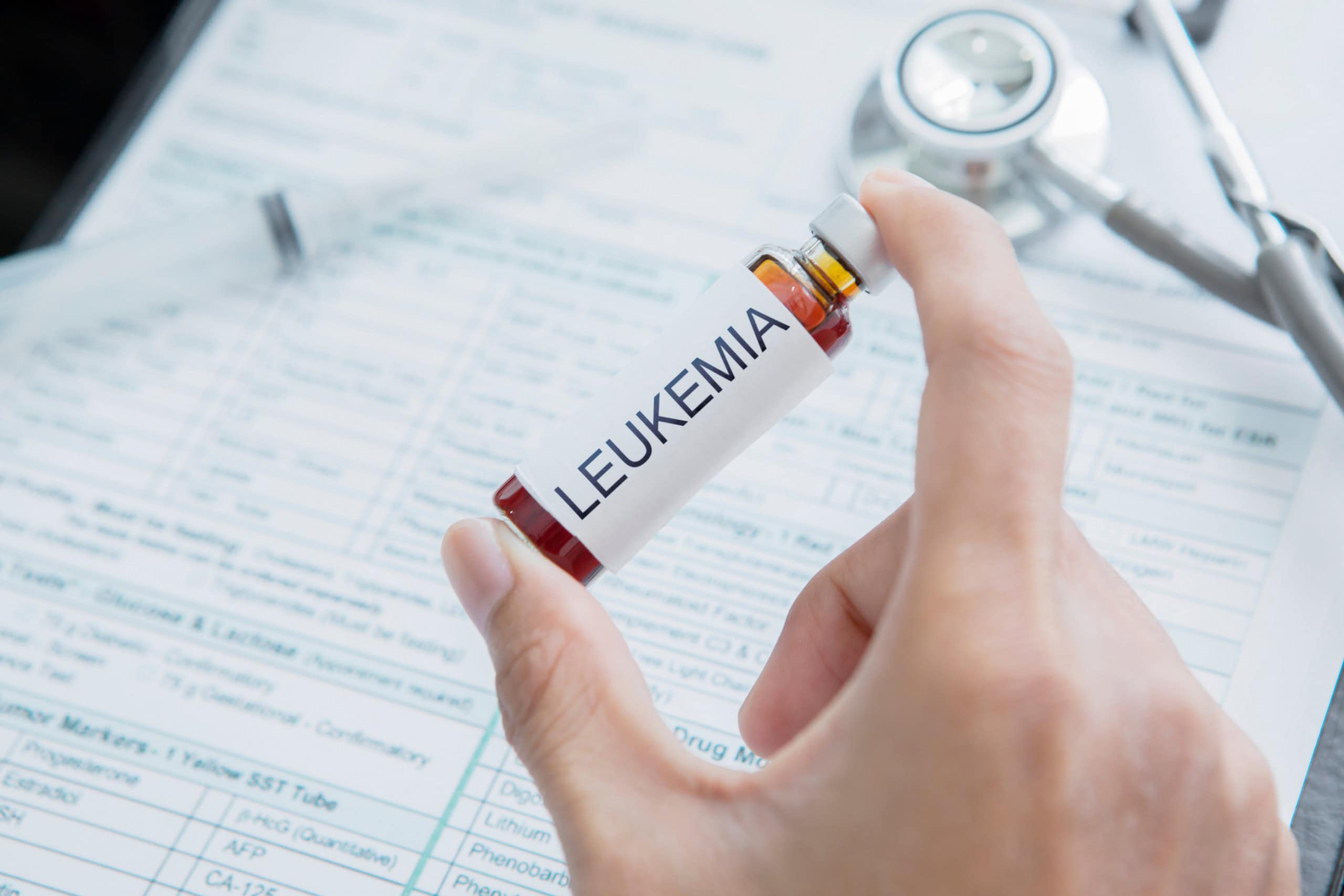 Nova terapia genética mostra remissão inédita em casos graves de leucemia