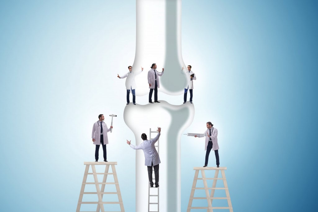 Nanomagnetos podem combater câncer ósseo; brasileiros estão no projeto Pesquisadores de Brasil e Portugal desenvolveram nanocompósitos magnéticos capazes de destruir tumores ósseos, responsáveis pelo câncer ósseo, por hipertermia e, ao mesmo tempo, favorecer a formação de novo tecido ósseo. Várias pessoas vestidas com jalecos brancos em cima de escadas e reconstruindo a representação de um osso gigante